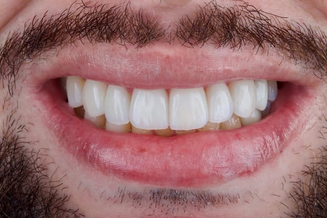 Bukal Odontología, Dr. Andersson Buritica photo 3
