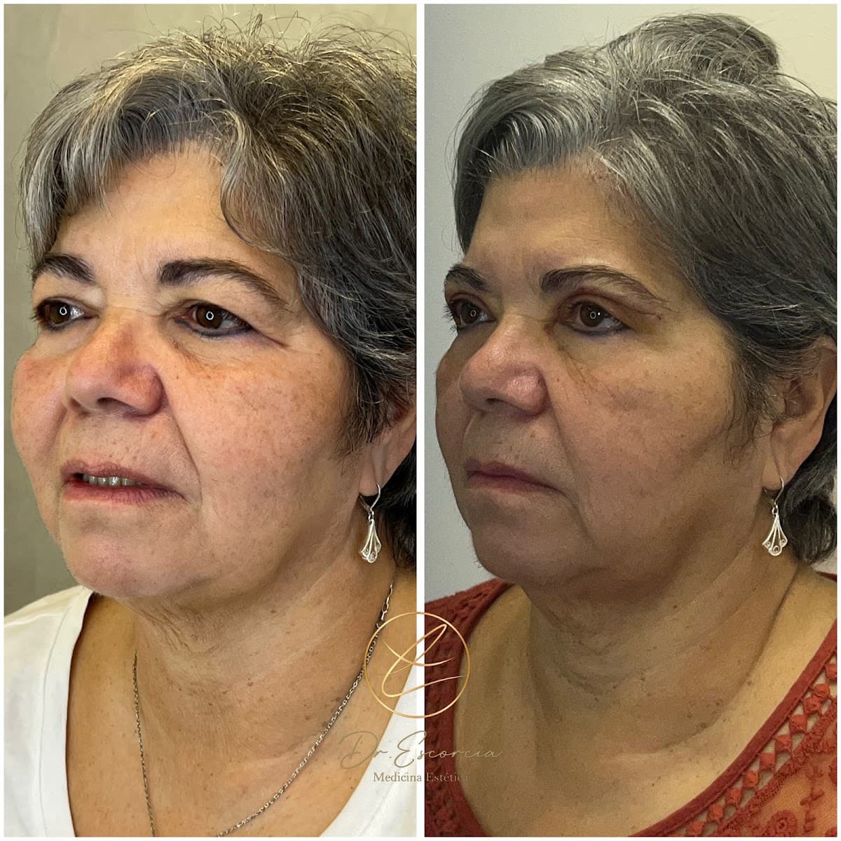 Dr. Escorcia Estética