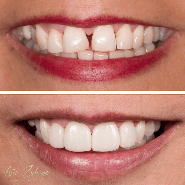 Dra. Ana Zuluaga - Diseño de sonrisa en Medellín photo 2