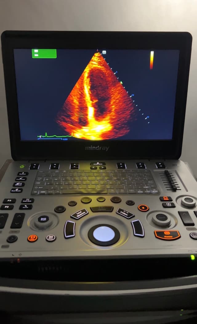 Ecocardioplus l Ecocardiograma en Medellín I Ecocardiograma particular