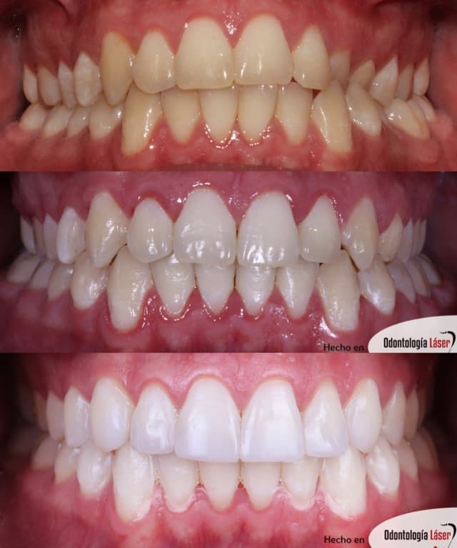 Odontología Láser (Galerías) photo 3