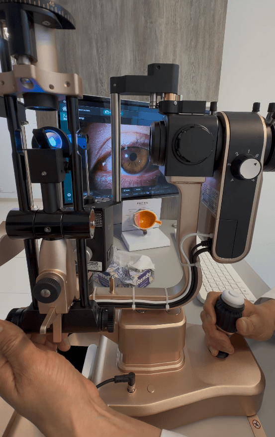 Optix Salud Ocular