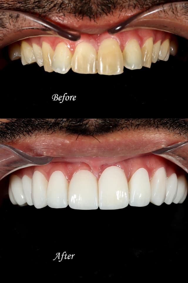 Premium Dental photo 2